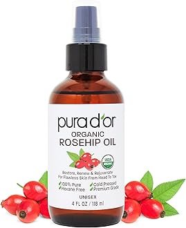 PURA D’OR 4 Oz ORGANIC Rosehip Seed Oil 100% Pure Cold Pressed USDA Certified Anti-Aging Youthful Look-Vitamin A & C Rich-Helps Fade Appearance of Scars & Stretch Marks – For Face, Hair & Body